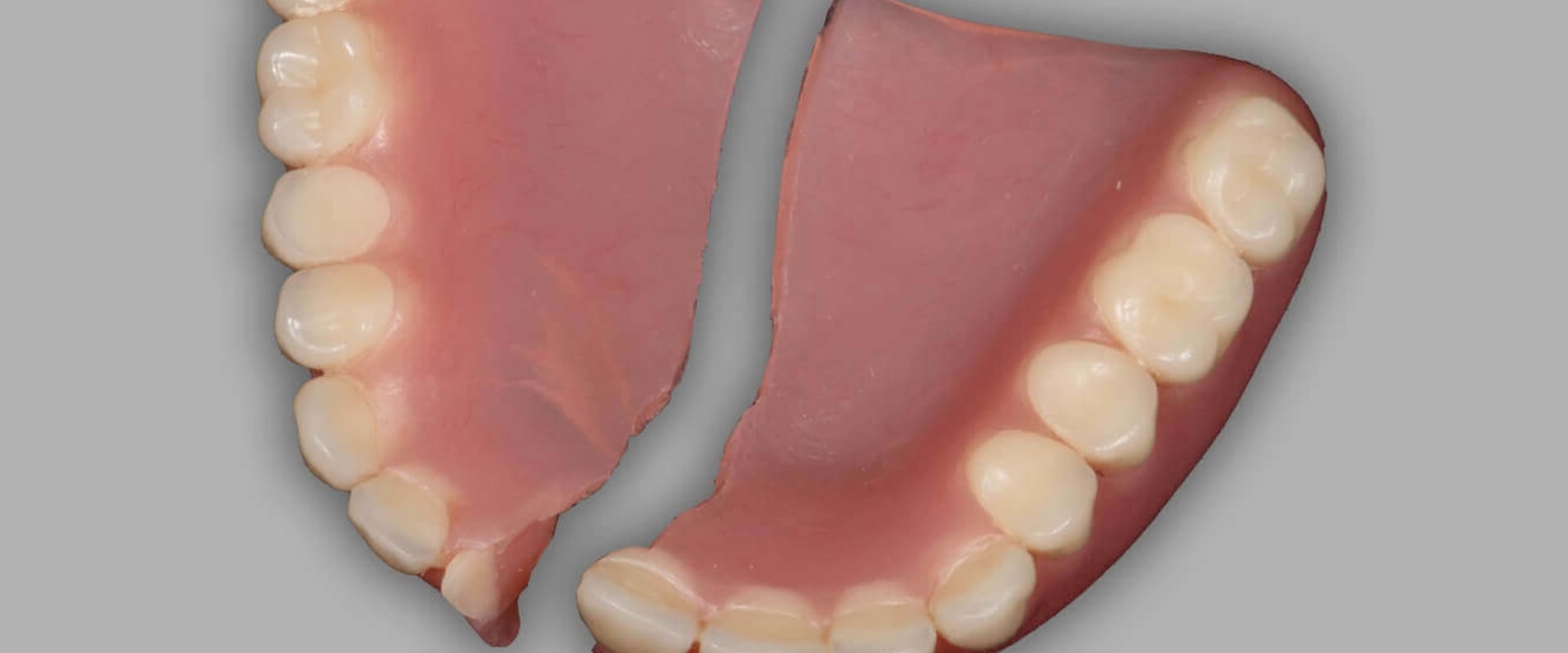 When to Seek Professional Denture Repair: Everything You Need to Know