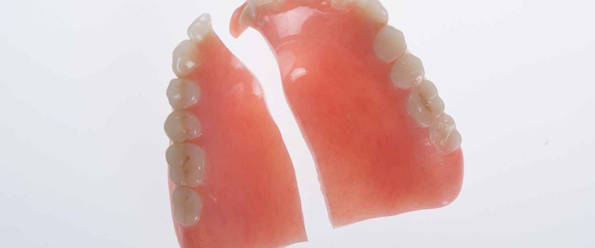 The Average Cost of Denture Repairs: What You Need to Know