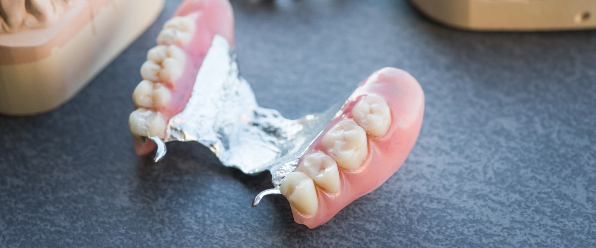 Pros and Cons of Partial Dentures