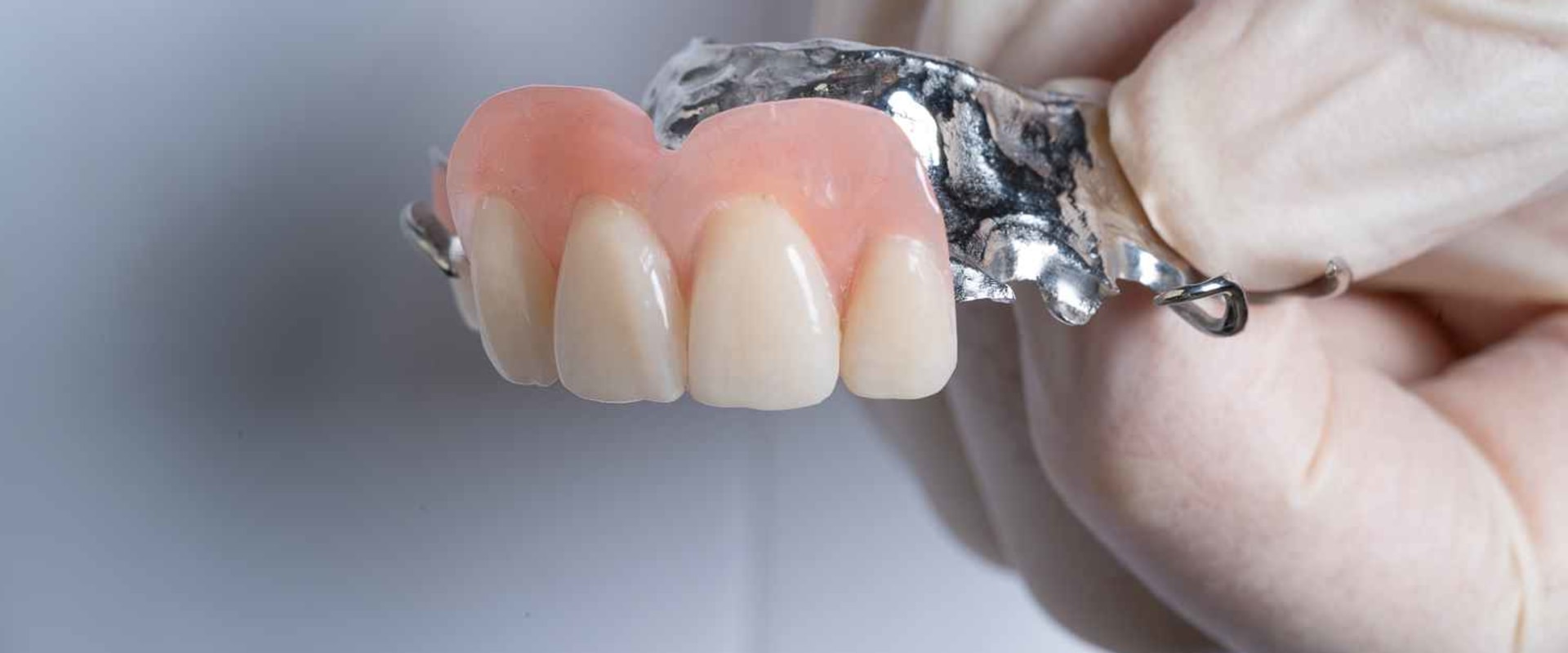 Understanding the Different Types of Partial Dentures