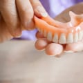 A Comprehensive Look at Denture Adhesives