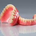 The Cost Comparison: Traditional Dentures vs. Alternative Options