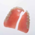 The Average Cost of Denture Repairs: What You Need to Know