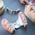 Pros and Cons of Partial Dentures