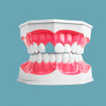 The Importance of Complete Dentures for Replacing Missing Teeth