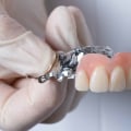 Understanding the Different Types of Partial Dentures