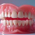 The Pros and Cons of Low-Cost Dentures: What You Need to Know