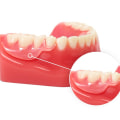 How to Care for Partial Dentures: A Comprehensive Guide