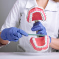 Common Mistakes to Avoid When Cleaning Dentures