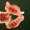 A Complete Guide to Common Concerns About Complete Dentures