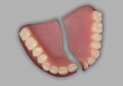 When to Seek Professional Denture Repair: Everything You Need to Know