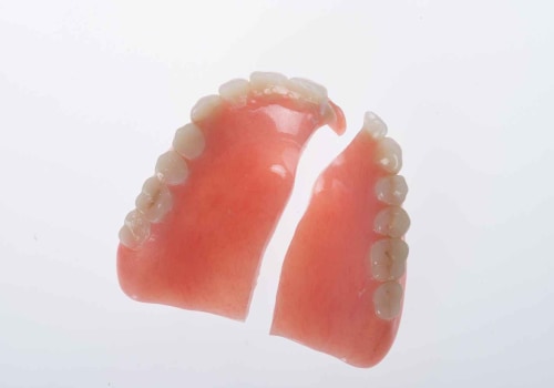 The Average Cost of Denture Repairs: What You Need to Know