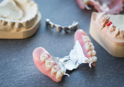 Pros and Cons of Partial Dentures