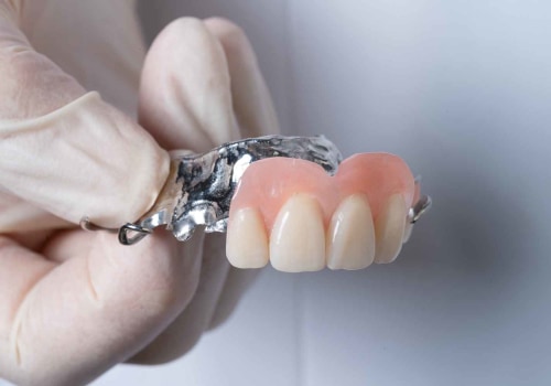 Understanding the Different Types of Partial Dentures